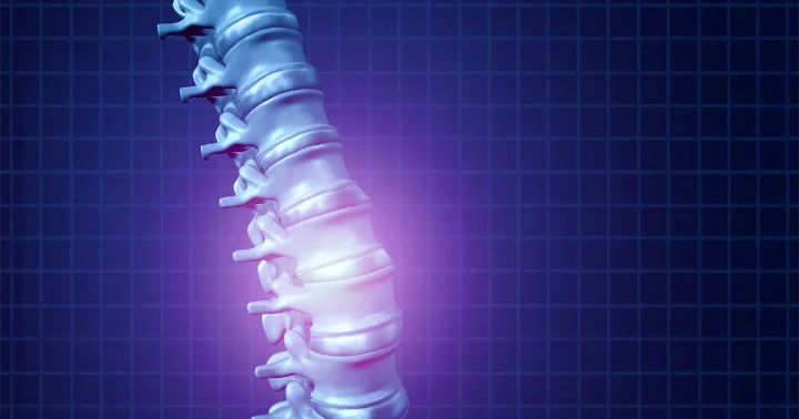 What Are Common Back Injuries After a Car Accident?